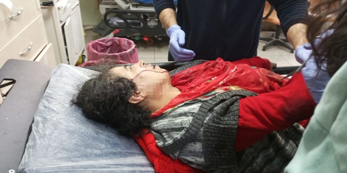 Yasaklı ırk köpek saldırdı