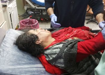 Yasaklı ırk köpek saldırdı